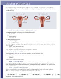 Reproductive Health Access Project | Ectopic Pregnancy Fact Sheet ...