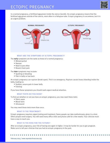 Reproductive Health Access Project | Ectopic Pregnancy Fact Sheet ...